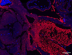 LGALS1 gene expression in a mouse embryonic heart